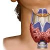 Заболевания щитовидной железы: симптомы и лечение